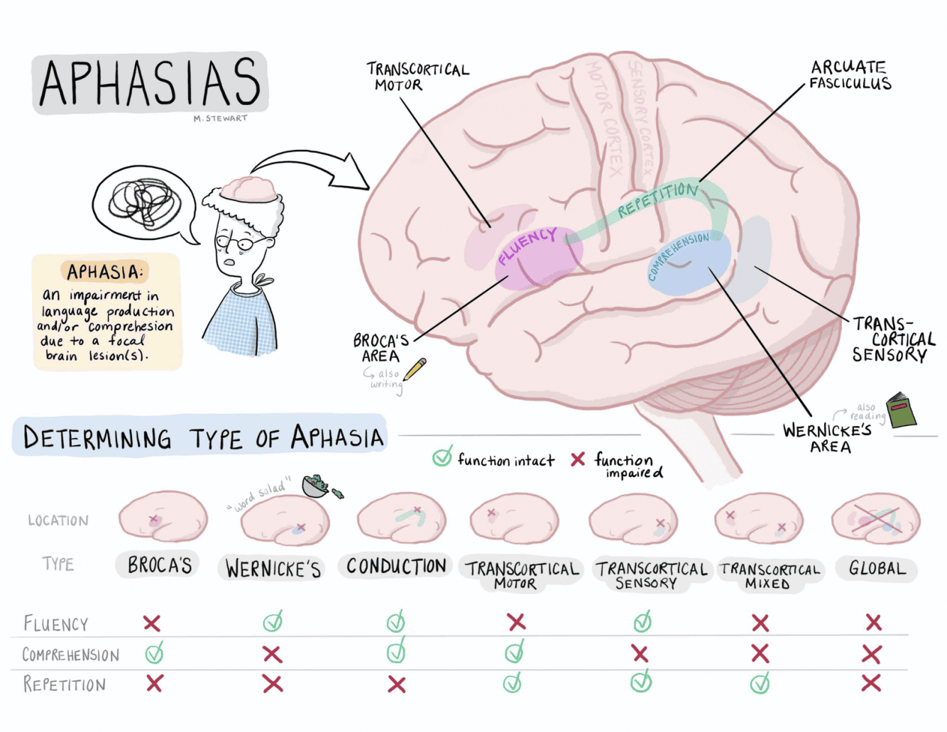Aphasia Punca Jenis dan Rawatan Tips Kesihatan